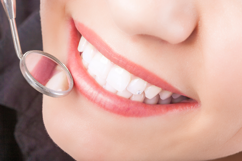 Should You Call Us to Get Dental Sealants?